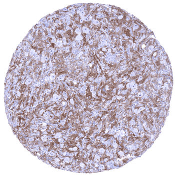 Factor XIII alpha antibody