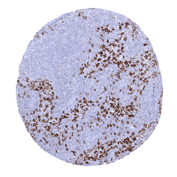 Factor XIII alpha antibody