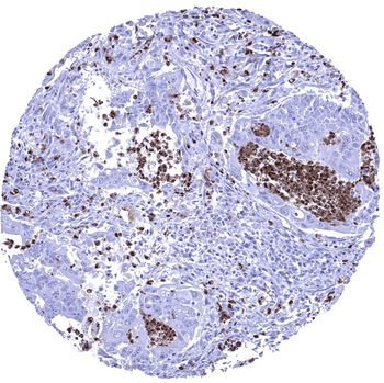 S100A12 antibody