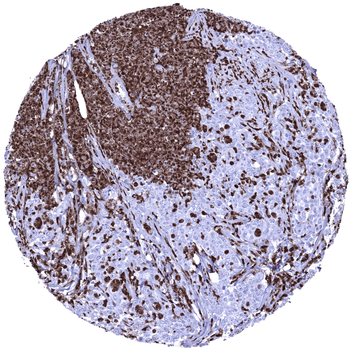 S100A12 antibody