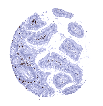 IgA antibody