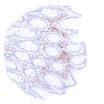 TIM3 antibody