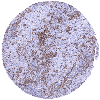 TIM3 antibody