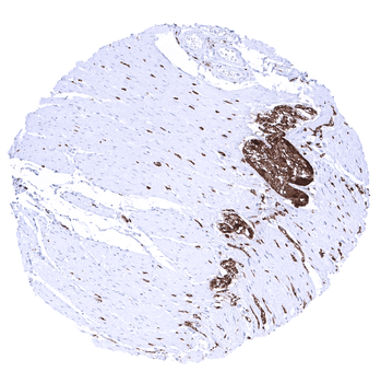 PGP9.5 / UCHL1 antibody