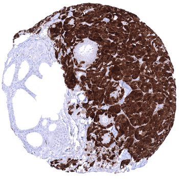 PGP9.5 / UCHL1 antibody