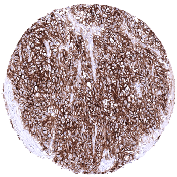 ACE2 antibody