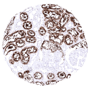 ACE2 antibody