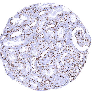 Histone H3 / H3-3A antibody