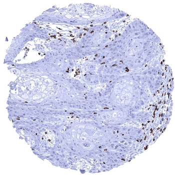 CD3 antibody