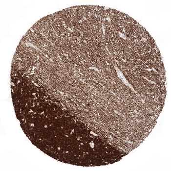 NSE gamma antibody