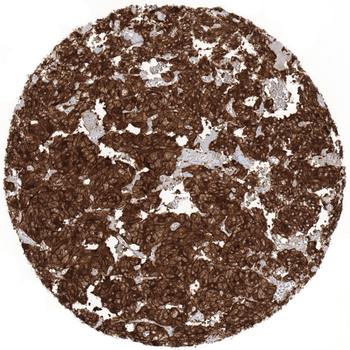 NSE gamma antibody