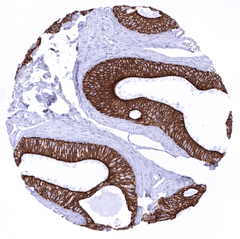 Cytokeratin 18 antibody