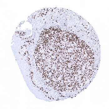 Ki-67 antibody
