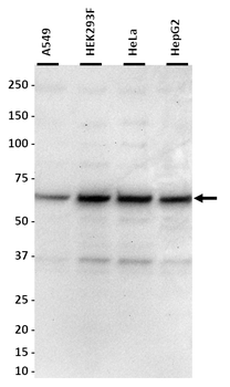 SLC27A2 Polyclonal Antibody