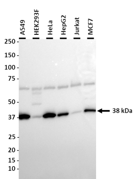 ANXA2 Rabbit Polyclonal Antibody