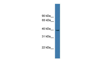 LTB4R Rabbit Polyclonal Antibody