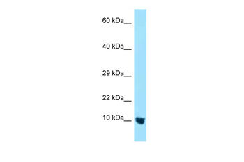 MTCP1NB Rabbit Polyclonal Antibody