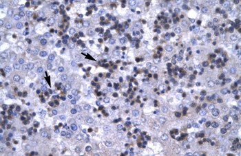 RBPSUH Rabbit Polyclonal Antibody