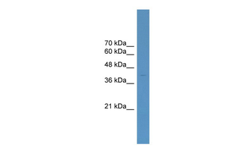 ELK4 Rabbit Polyclonal Antibody