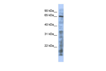 HTATIP Rabbit Polyclonal Antibody
