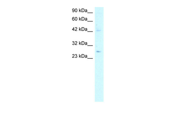 ACDC Rabbit Polyclonal Antibody