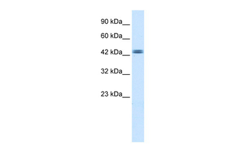 TTRAP Rabbit Polyclonal Antibody