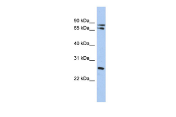 OVOL2 Rabbit Polyclonal Antibody