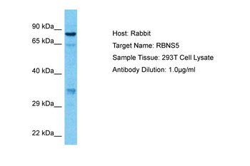 RBSN Rabbit Polyclonal Antibody