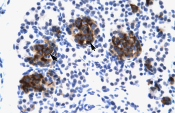 ZNF21 Rabbit Polyclonal Antibody