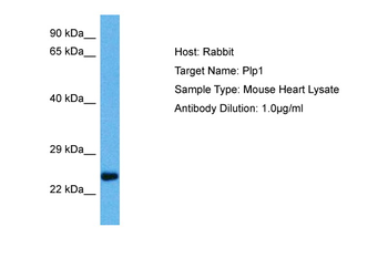PLP1 Rabbit Polyclonal Antibody
