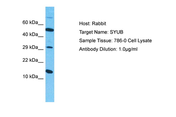 SNCB Rabbit Polyclonal Antibody