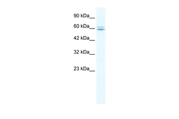CBFA2T3 Rabbit Polyclonal Antibody