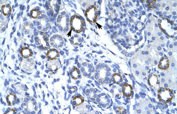 C19ORF6 Rabbit Polyclonal Antibody