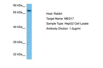 CRSP6 Rabbit Polyclonal Antibody