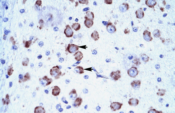 CRSP6 Rabbit Polyclonal Antibody