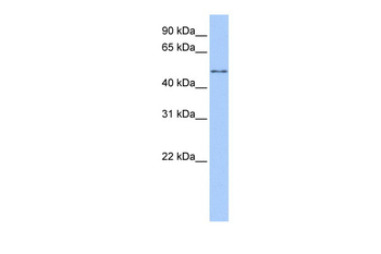 CCT8L2 Rabbit Polyclonal Antibody