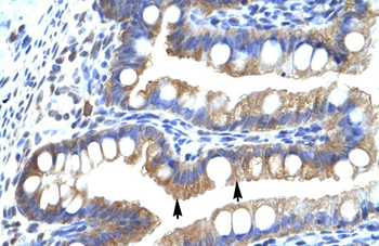 CLIC5 Rabbit Polyclonal Antibody