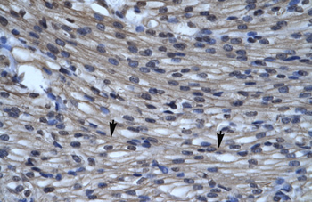 CLIC5 Rabbit Polyclonal Antibody