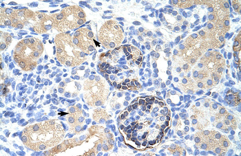 CLIC5 Rabbit Polyclonal Antibody