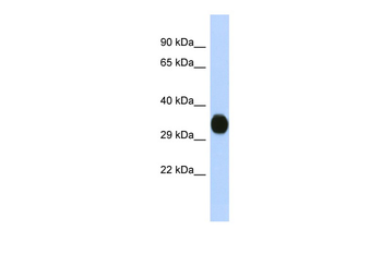 KCNAB2 Rabbit Polyclonal Antibody