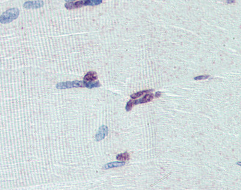 PRDM9 Rabbit Polyclonal Antibody