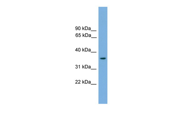 Foxf1a Rabbit Polyclonal Antibody