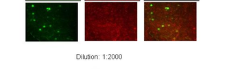 KCNAB2 Rabbit Polyclonal Antibody