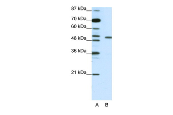 KCNAB2 Rabbit Polyclonal Antibody