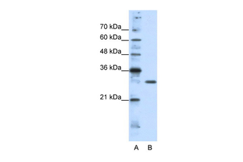 GSCL Rabbit Polyclonal Antibody