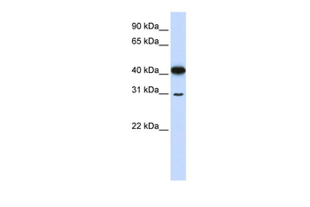 OVOL2 Rabbit Polyclonal Antibody
