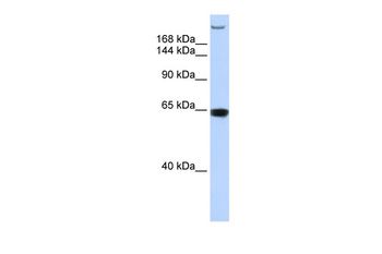 TNRC6A Rabbit Polyclonal Antibody