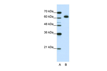 MGC42174 Rabbit Polyclonal Antibody