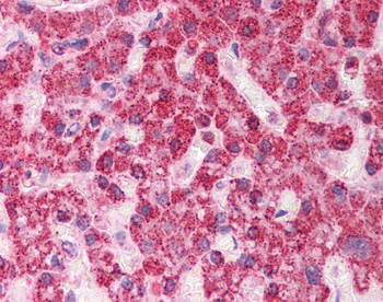 TST Rabbit Polyclonal Antibody