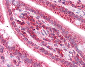 TST Rabbit Polyclonal Antibody